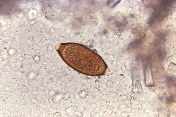 Cacing Cambuk (Trichuris trichiura): Penjelasan Komprehensif