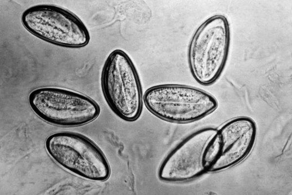 Cacing Kremi (Enterobius vermicularis): Penjelasan Komprehensif