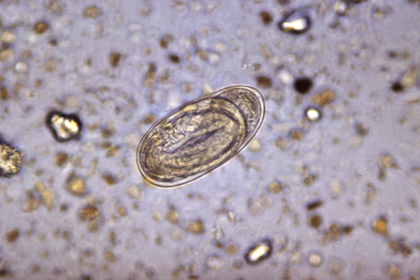 Cacing Tambang (Ancylostoma duodenale): Penjelasan Komprehensif