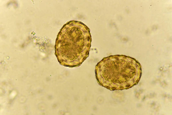 Cacing Gelang (Ascaris lumbricoides): Penjelasan Komprehensif
