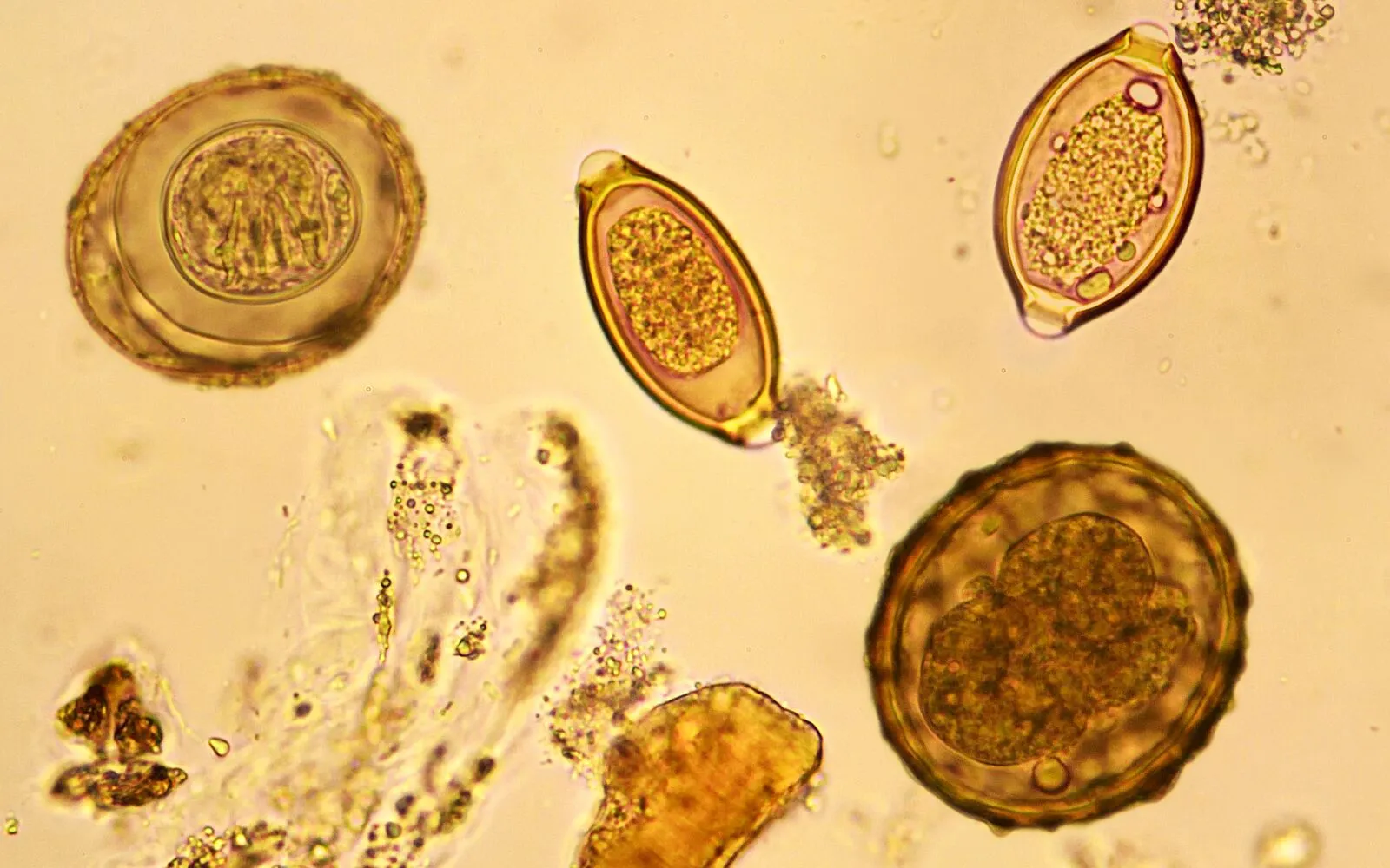 Apa Sebenarnya Parasitologi Itu?