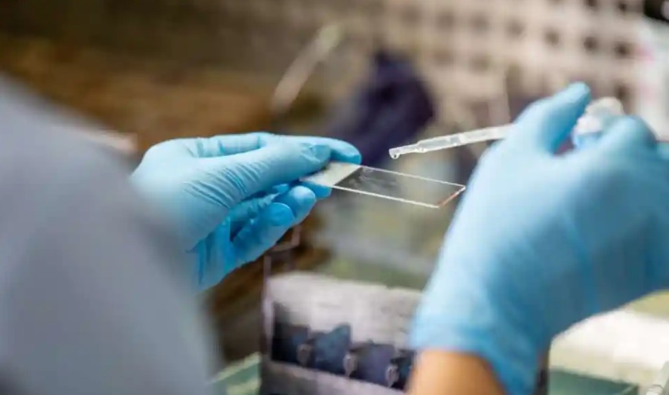 Interpretasi Hasil Laboratorium untuk Diagnosis TBC