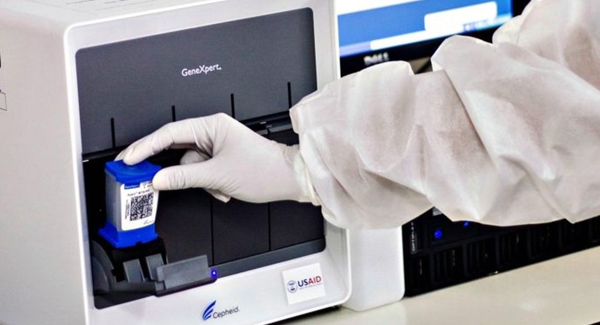 Munculnya TCM mempercepat proses diagnosis MTB.